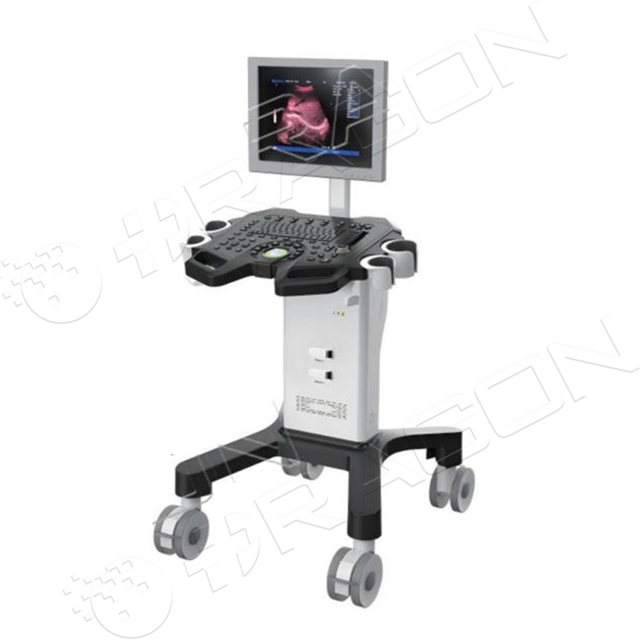 Ultrasound System RAD-US02