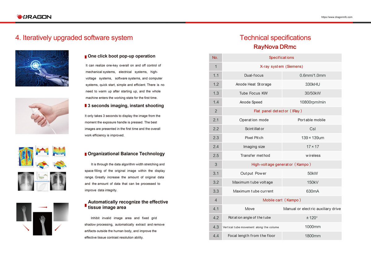 Digital Mobile X-ray Machine
