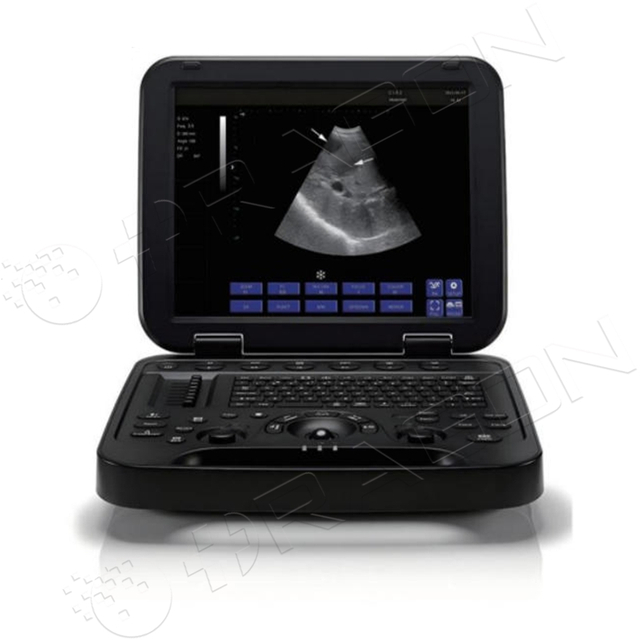 Ultrasound System RAD-US06