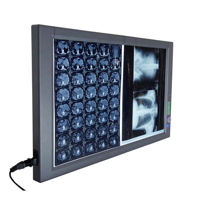 LED X-Ray Film View Box(2A)