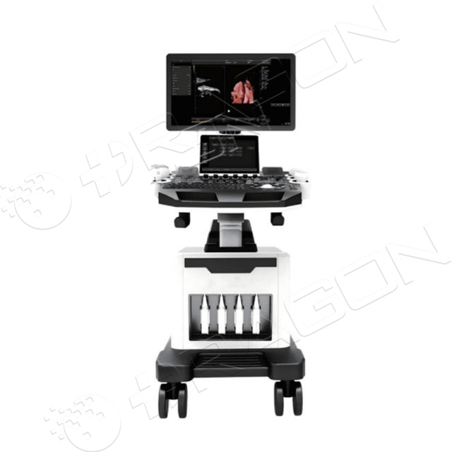 Ultrasound System RAD-US01