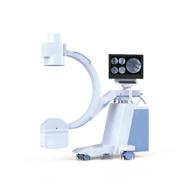 High Frequency Mobile C-arm System