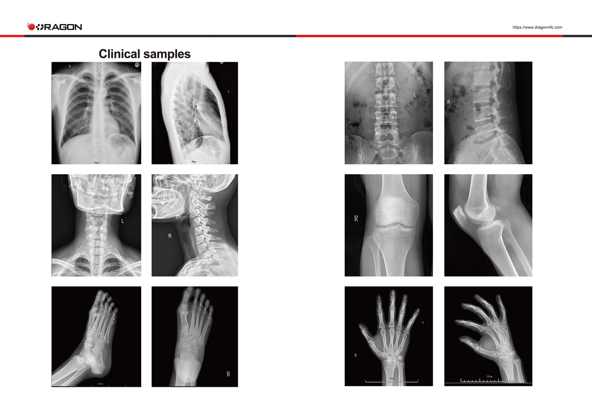 Digital X-ray Radiography System
