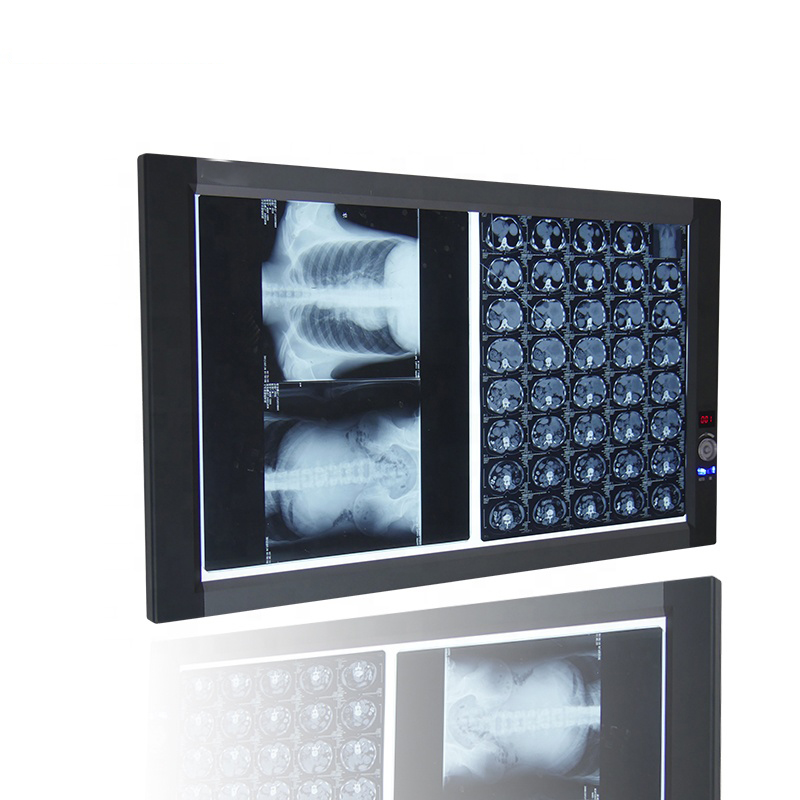 LED X-Ray Film View Box(2B)