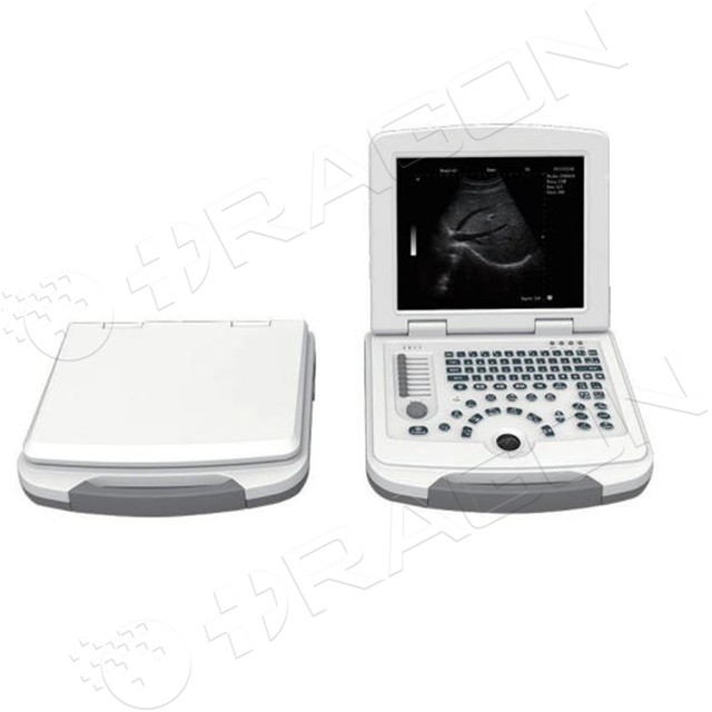 Ultrasound System RAD-US03